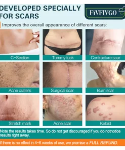 Fivfivgo™ ScarRemove Advanced Scar Spray