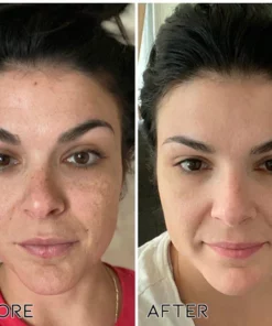 Fivfivgo™ Super-B Dark Spot Corrector Serum