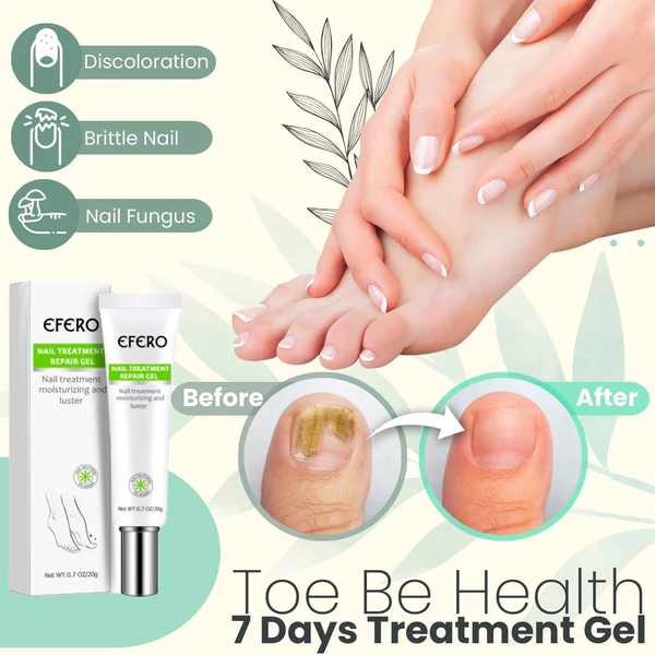 Flyles™ Nail Repair Treatment Gel