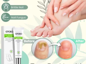 Flyles™Nail Repair Treatment Gel