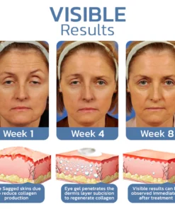 Flysmus™ OPENEYES Awaken Peptide Lifting Eye Gel