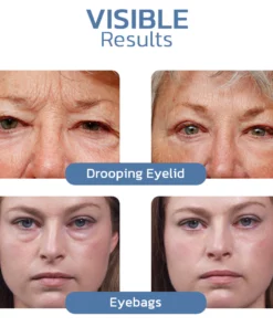 Flysmus™ OPENEYES Awaken Peptide Lifting Eye Gel