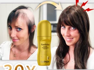 Fortifolix Growth Accelerating Hair Oil