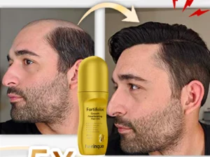Fortifolix Growth Accelerating Hair Oil