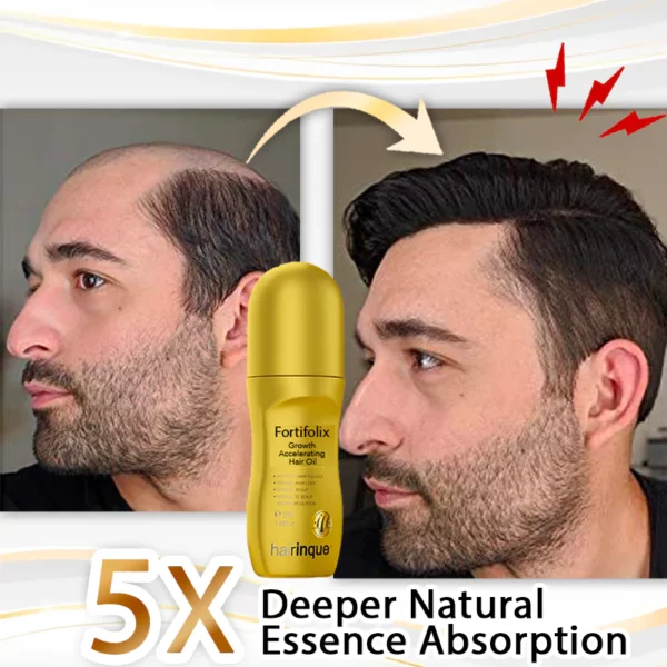 Fortifolix чачтын өсүшүн тездетүүчү май