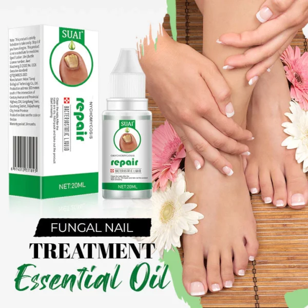 Aceite esencial de tratamento de unhas con fungos