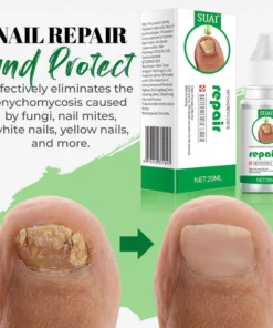 Fungal Nail Treatment Essential Oil