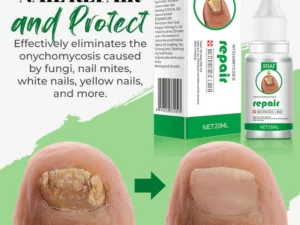 Fungal Nail Treatment Essential Oil