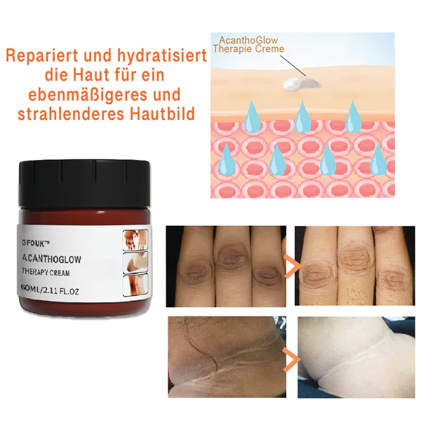 GFOUK™ AcanthoGlow Therapie kremas