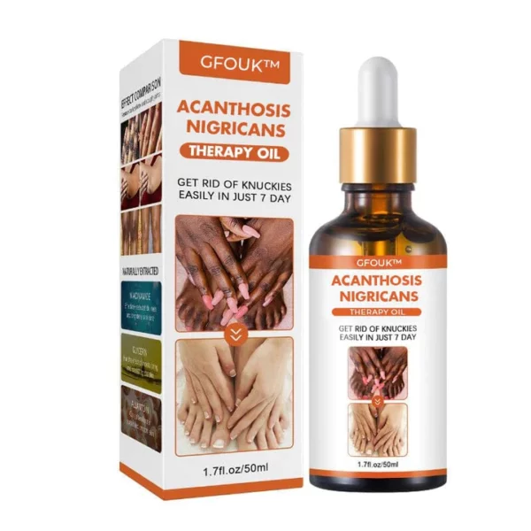 GFOUK ™ Acanthosis Nigricans Relief Oil