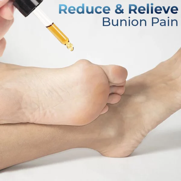 Minyak Relief Bunion Jerman GFOUK™