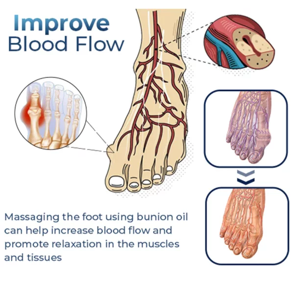 Ola Faoisimh Bunion Gearmánach GFOUK™