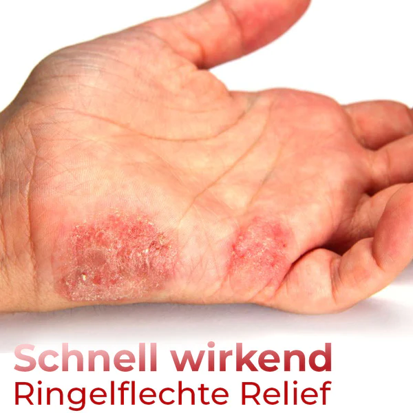 GFOUK™ Hand-Ringelflechte-Entlastungsspray