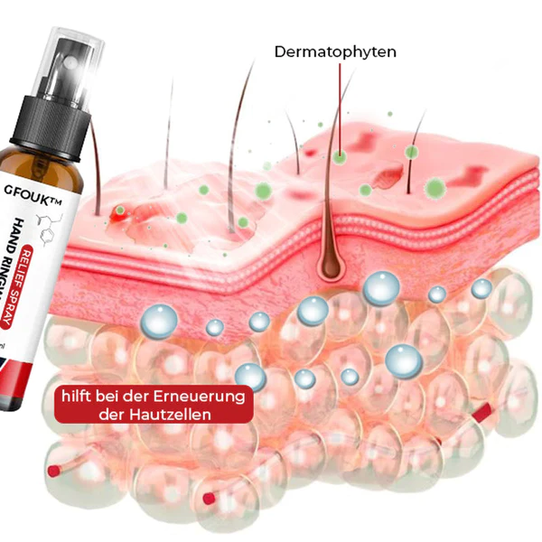 GFOUK™ Hånd Ringelflechte Entlastung Spray