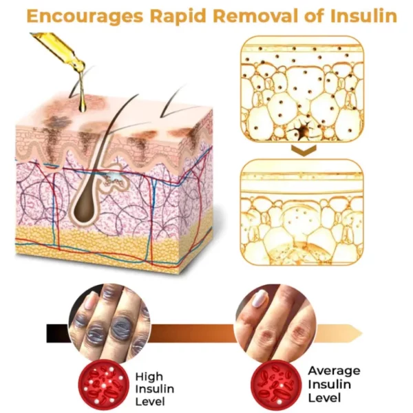 قطرات العلاج GFOUK ™ NigriCare