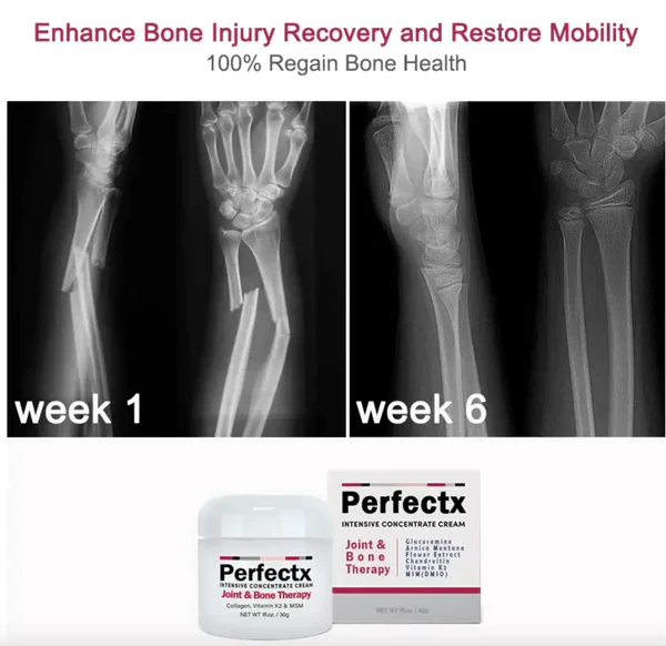 GFOUK™ Perfectx Joint and Bone Therapy Cream