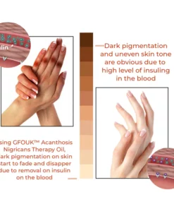 GFOUK™ A.N. Therapy Drops