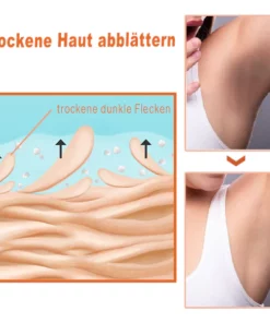 GFOUK™ AcanthoGlow Therapie Creme