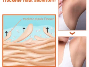 GFOUK™ AcanthoGlow Therapie Creme