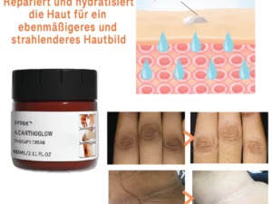 GFOUK™ AcanthoGlow Therapie Creme