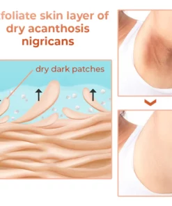 GFOUK™ Acanthosis Nigricans Therapie-Öl
