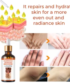 GFOUK™ Acanthosis Nigricans Therapy Oil