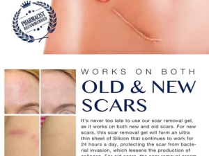 GFOUK™ Advanced Silicone Skin Renewal Gel