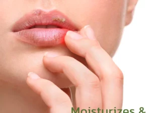 GFOUK™ Blistfix Herbal Medicated Lip Balm