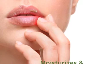 GFOUK™ Blistfix Medizinischer Lippenbalsam auf Kräuterbasis