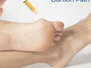 GFOUK™ German Bunion Relief Oil