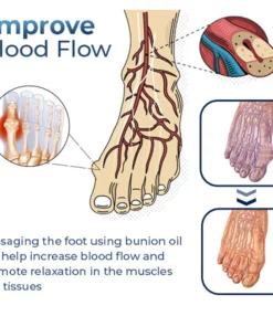 GFOUK™ German Bunion Relief Oil