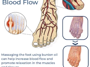 GFOUK™ German Bunion Relief Oil