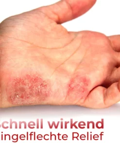 GFOUK™ Hand Ringelflechte Entlastung Spray