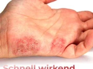 GFOUK™ Hand Ringelflechte Entlastung Spray