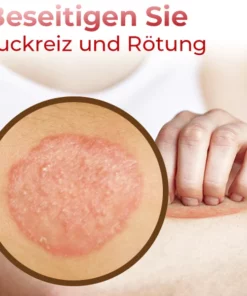 GFOUK™ Hand Ringelflechte Entlastung Spray