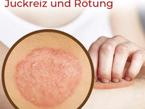 GFOUK™ Hand Ringelflechte Entlastung Spray