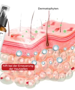 GFOUK™ Hand Ringelflechte Entlastung Spray