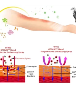 GFOUK™ Hand Ringworm Relief Spray