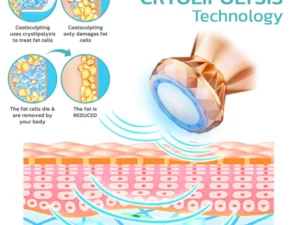 GFOUK™ Mikrostrom Kryolipolyse Mini-Massagegerät