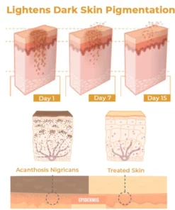 GFOUK™ NigriCare Therapy Drops