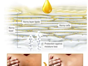 GFOUK™ NigriCare Therapy Drops