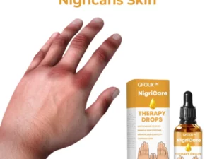 GFOUK™ NigriCare Therapy Drops