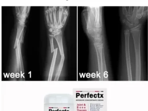 GFOUK™ OsteoRevive Advanced Support Cream