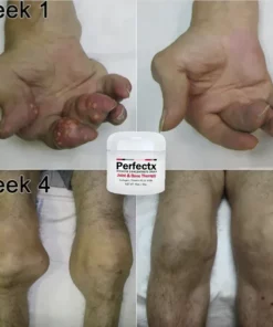 GFOUK™ Perfectx Gelenk- und Knochentherapie-Creme