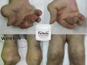 GFOUK™ Perfectx Gelenk- und Knochentherapie-Creme