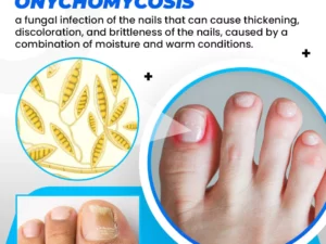 German AntiFungi MicroShield Socks