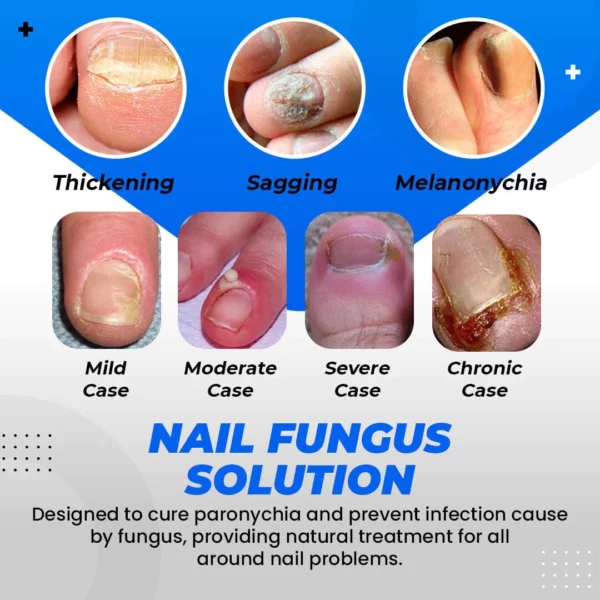 Германски AntiFungi MicroShield чорапи