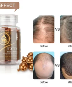 Ginproth natural plant hair growth capsule essential oil