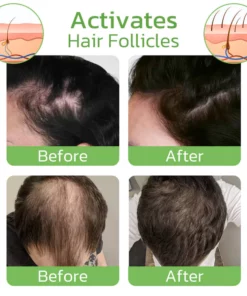 GrowthPlus Nourishing Ginger Spray