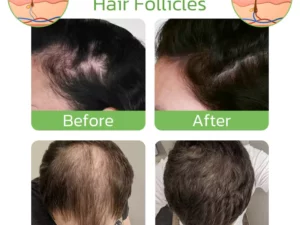 GrowthPlus Nourishing Ginger Spray
